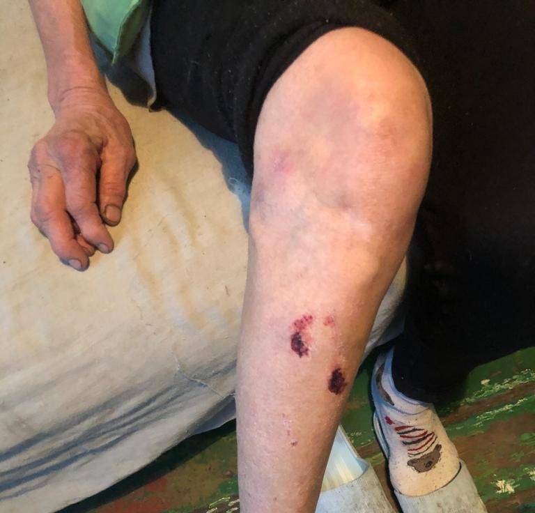 В Миллерово пожилая пенсионерка пострадал от халатности чиновников Ростелекома